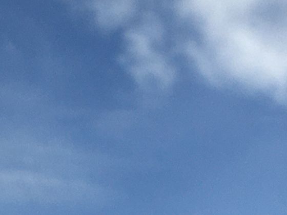 男人肾虚的表现症状有哪些